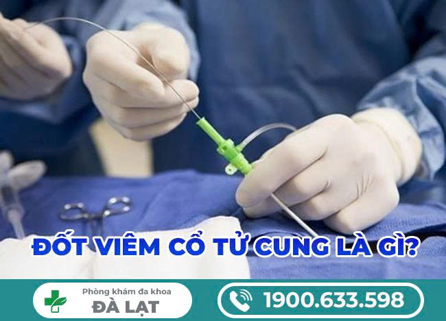 Hình ảnh minh họa